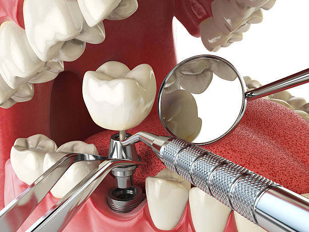 Best Broken or Cracked Tooth Emergency Dentist in South Temple, PA